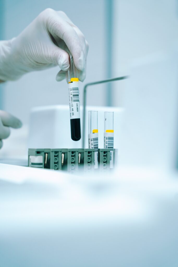 Image of person holding blood test tubes